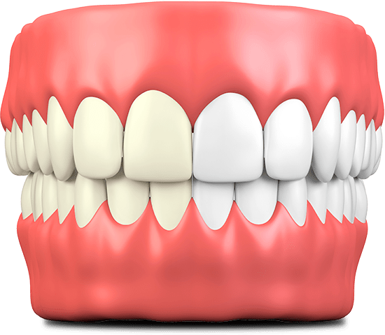 KOR Teeth Whitening System | Chaska, MN | Relaxation Dentistry