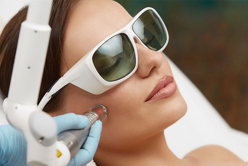 female patient having facial laser treatment