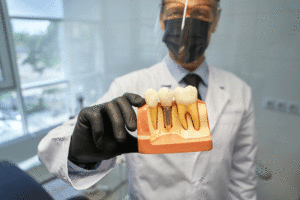 Doctor holding a model of a dental implant.